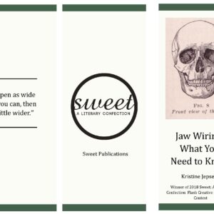 Jaw Wiring: What You Need To Know by Kristine Jepsen